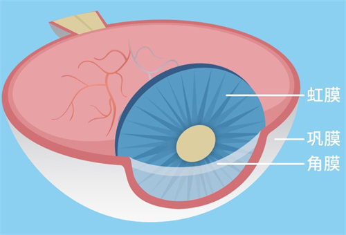 后巩膜加固手术怎么做用把眼球取出来吗?并不需要哟!改善视力问题是不错选择