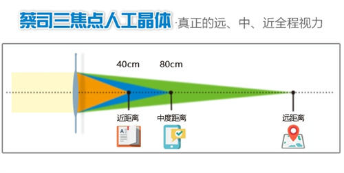 爱尔康三焦晶体植入多少钱，属于高端人工晶体价格在23000元起！