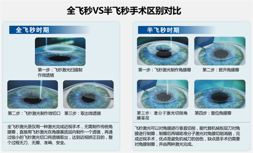 曲靖做近视眼手术的价格表一览:全飞秒8.8k+|半飞秒6.8k+|晶体植入19k+