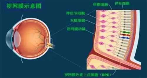 爱尔眼科医院视网膜脱落手术做得好吗?好 视网膜脱落手术是爱尔眼科的擅长项目！