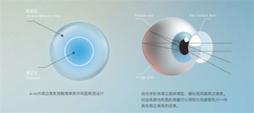 捷安视离焦软镜怎么样价格多少钱，防控近视优势明显价格960元起！