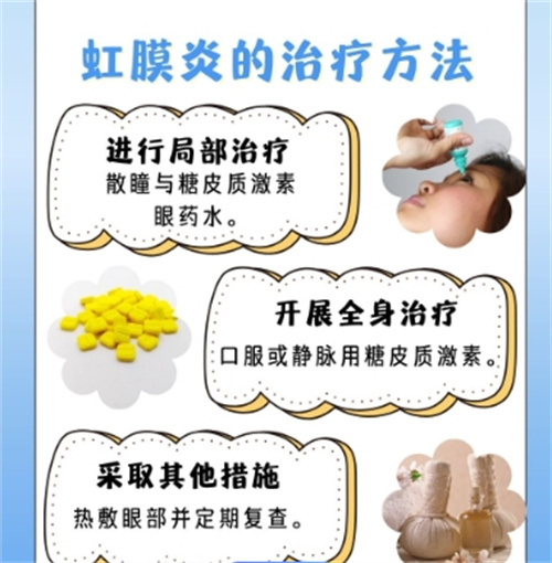 虹膜炎的治疗方法细节图.jpg