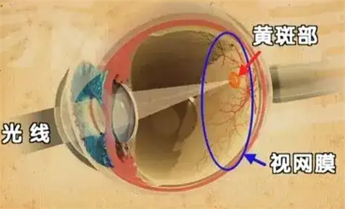 黄斑眼病的发病位置图解