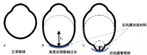 沈阳四院眼科做手术官网价格表，请参考这份2025年更新后的价格表！
