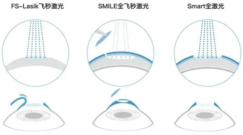 十堰太和医院眼科医生介绍表，附上各位医生擅长项目和手术特点！