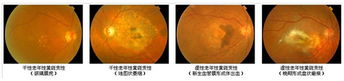 普瑞眼科2025年官方价格整理