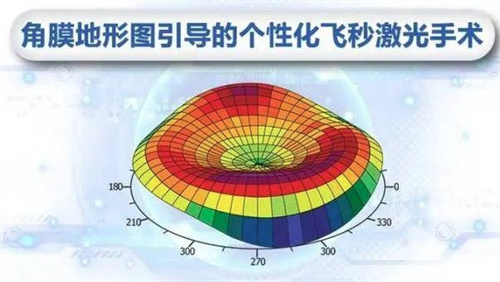 个性化飞秒激光手术