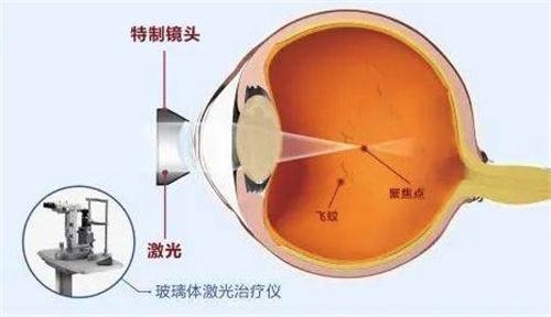 重庆西南医院眼科预约挂号流程分享，线上预约平台目前有三种！