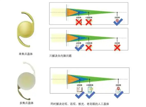 单焦点和多焦点的原理对比