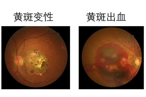 分享重庆西南医院眼科在线挂号预约方式，线上预约这两种方式容易操作！