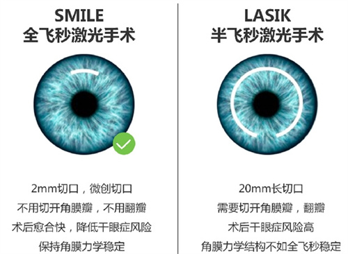 绍兴市中心医院眼科收费标准公布，含近视手术/白内障/青光眼等价格！