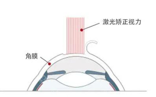 石家庄麦迪格眼科医院怎么样？裕华区的正规眼科，设备全！