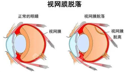 利川人民医院眼科如何预约挂号？分享三种简便的线上预约操作方式！