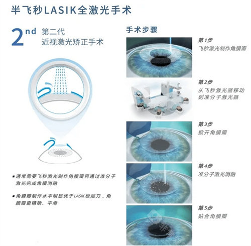 昆明华厦眼科全方位揭秘:如何预约+正规性解读+手术效果大起底