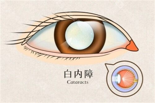 济宁哪家眼科医院比较好?儿童近视/安假眼/白内障可去启明眼科！