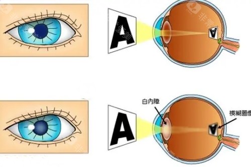 河北省眼科医院石家庄分院怎么样?分析：设备/价格/医生/口碑供参考!