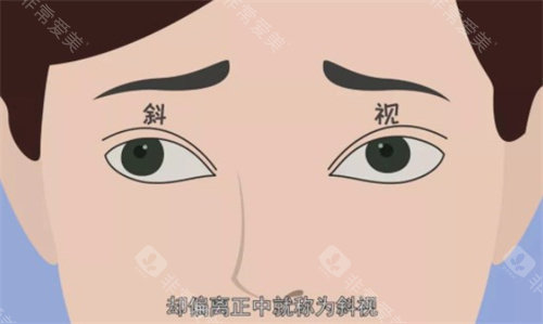 北京熙仁眼科做儿童近视/斜视/弱视手术好的医生是王乐今、刘刚、李晓清医生,技术好!