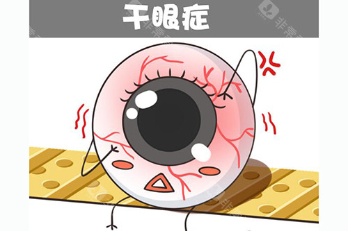干眼症卡通图展示