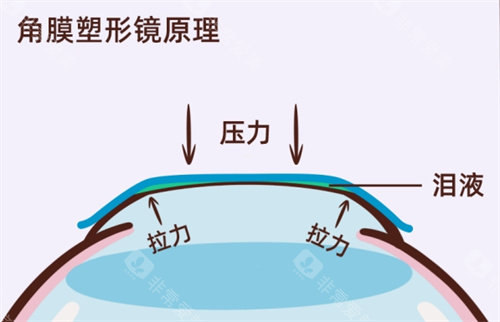 毕节阳明眼科医院是私立眼科哦！无论技术还是口碑以及其他服务都不疏综合医院！