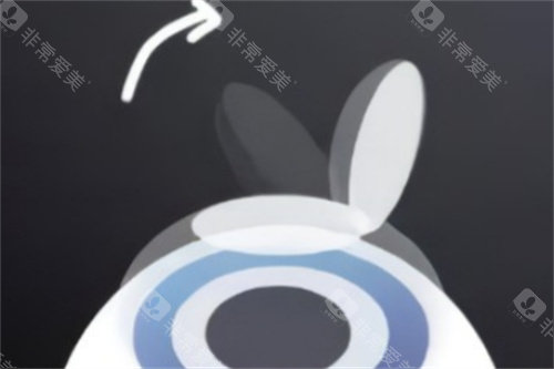 兴宁市人民医院眼科价格表查询，近视矫正7000元起/白内障5000元起/角膜塑形镜4500元起！