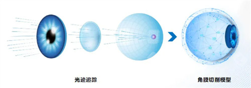 全光塑治疗模型