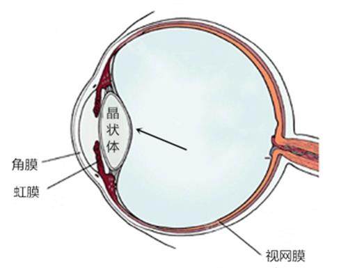 眼球结构示意图