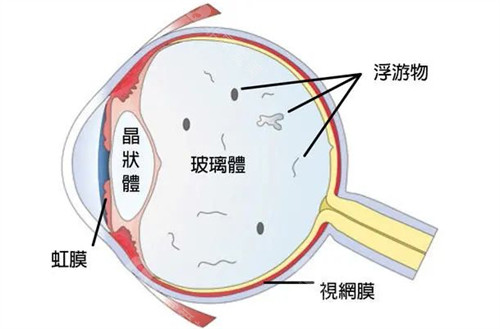 眼球结构图