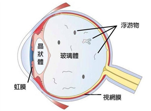 玻璃体图示