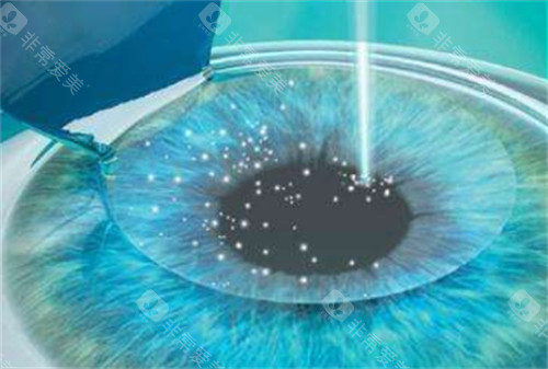 石家庄省二院眼科电话号码查询：拨打0311-87023357预约，近视/白内障/斜弱视均可去看看！