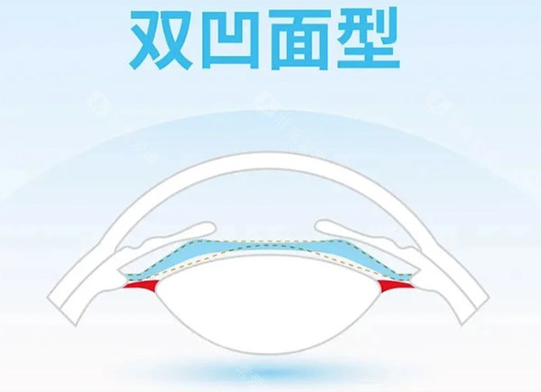 龙晶pr人工晶体双凹面设计