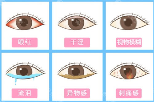 干眼症症状