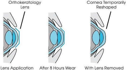 山东大学齐鲁医院眼科价格表2025年新版查询：青光眼、眼底病、角膜移植、儿童近视防控免费看！