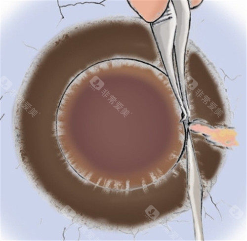 角膜动画图