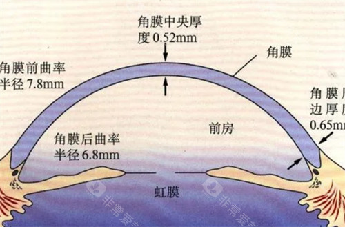 圆锥角膜数据分析图解