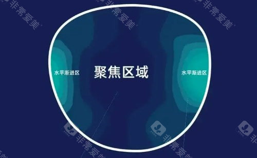 罗敦司得迈控镜片聚焦区域