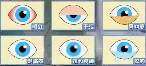 眼部疾病明细图