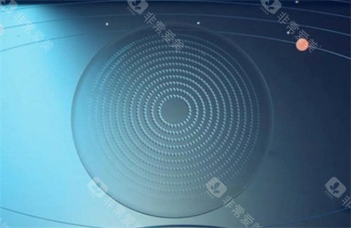 星趣控镜片
