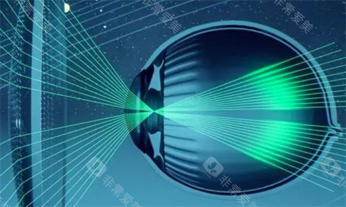 星趣控镜片示意图