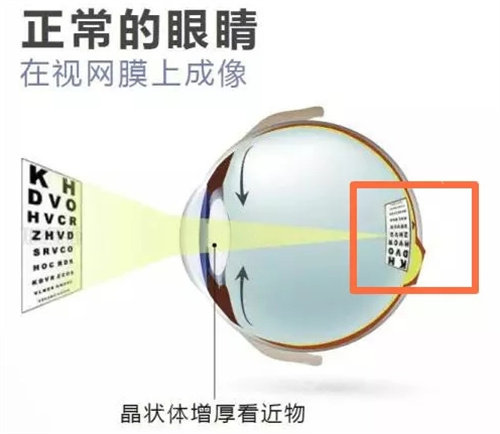 正常眼睛看到的样子
