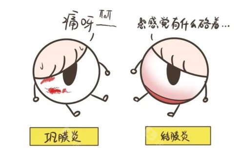 巩膜炎与结膜炎卡通对比图