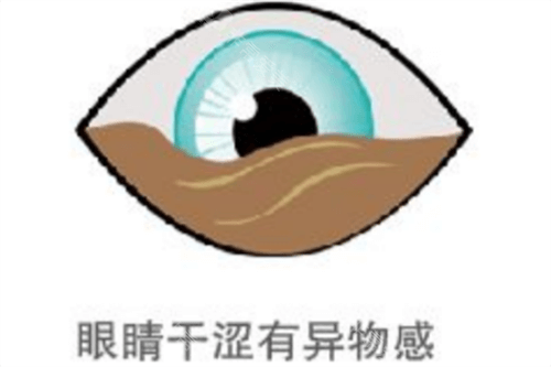 眼睛干涩有异物感