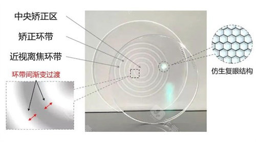 成都青白江苏扬眼科配近视镜靠谱吗？从配镜技术到收费标准，真实测评来了