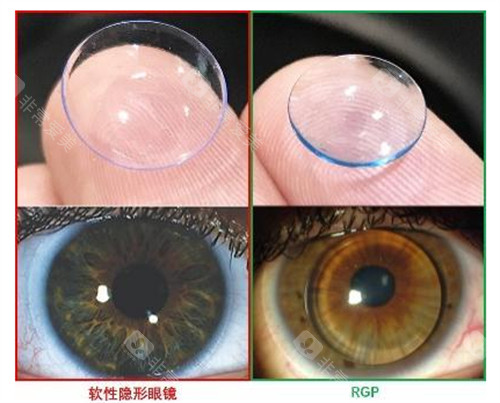 rgp和隐形眼镜区别