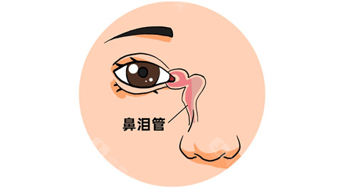 泪道阻塞常规堵塞的位置