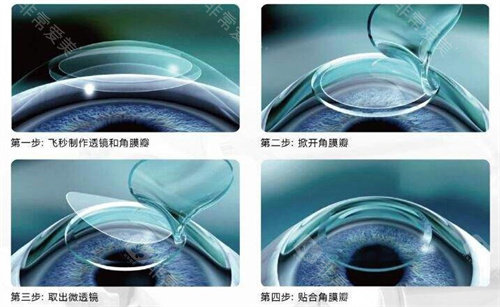 昆明景远眼科好不好？卫健委认证、新型设备加持，口碑说明了一切！
