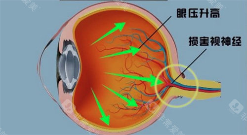 视神经结构