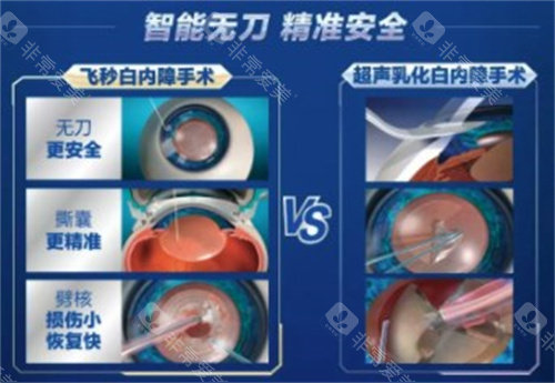 纠结！白内障手术选单焦还是多焦？一文看懂两者区别+选择攻略