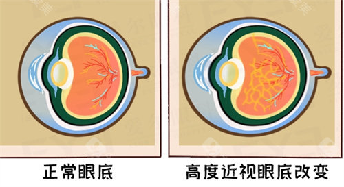 眼底视力呈现