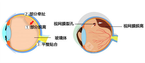 福州附属第一医院眼科医生哪个好？各位备受好评的眼科医生擅长领域和患者评价都有！