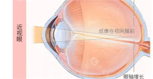 河北医科大学第四医院眼科电话拨打0311-86095588,视网膜病变与斜弱视科室是它家擅长的!